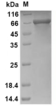 SARS-CoV-2 NSP2 (E.coli, C-6His) 